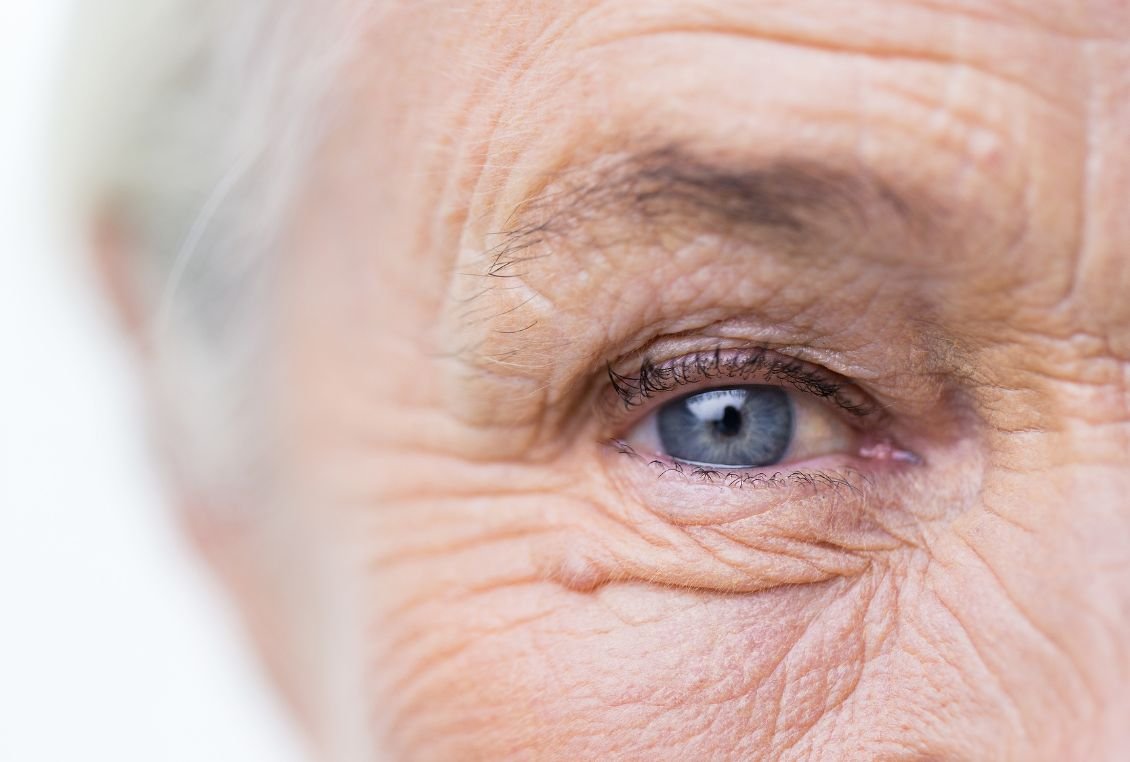 How to Control Early Signs of Aging