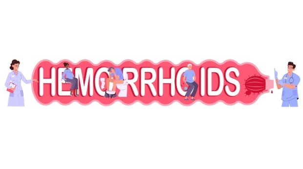 Hemorrhoid