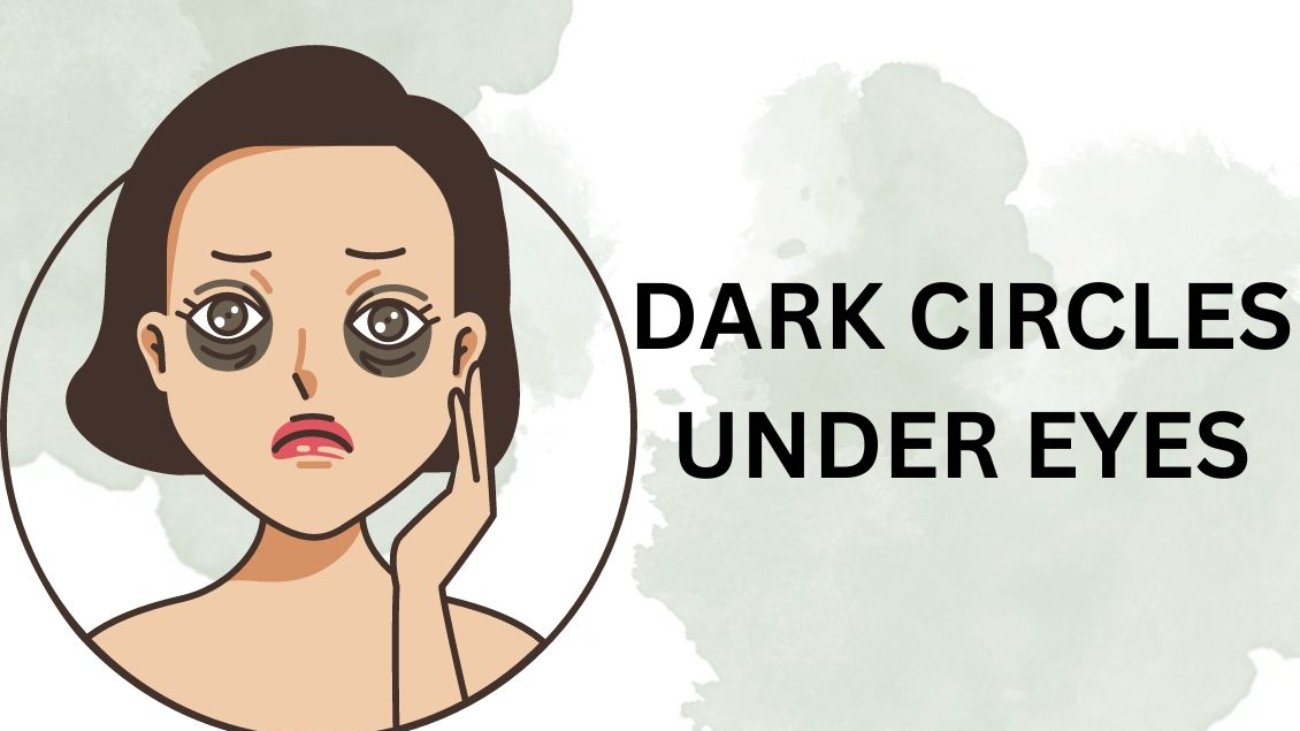 How to Cover Dark Circles Naturally