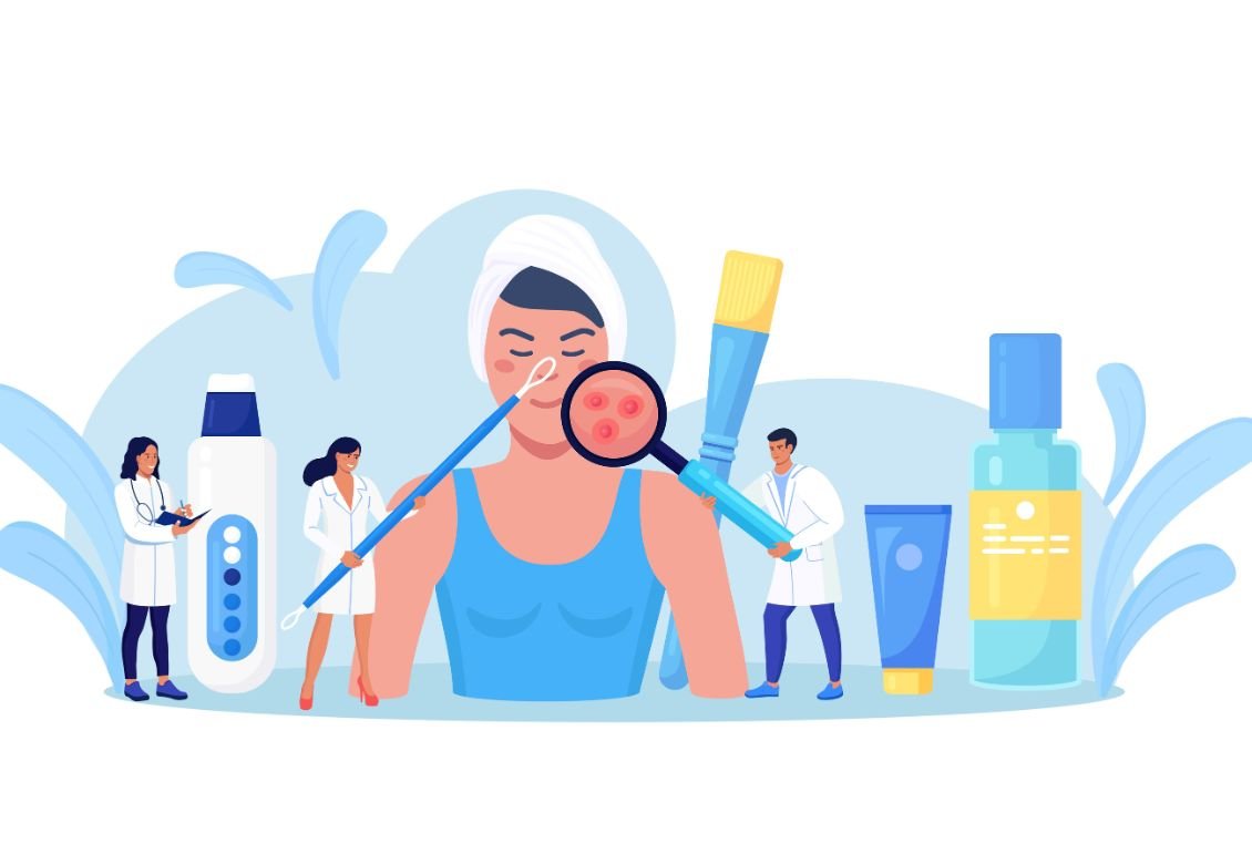 What is Acne and How to Manage It