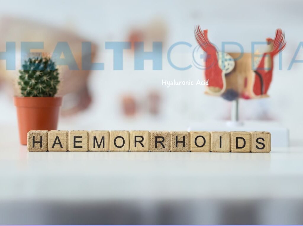 The Ultimate Guide to Hemorrhoids