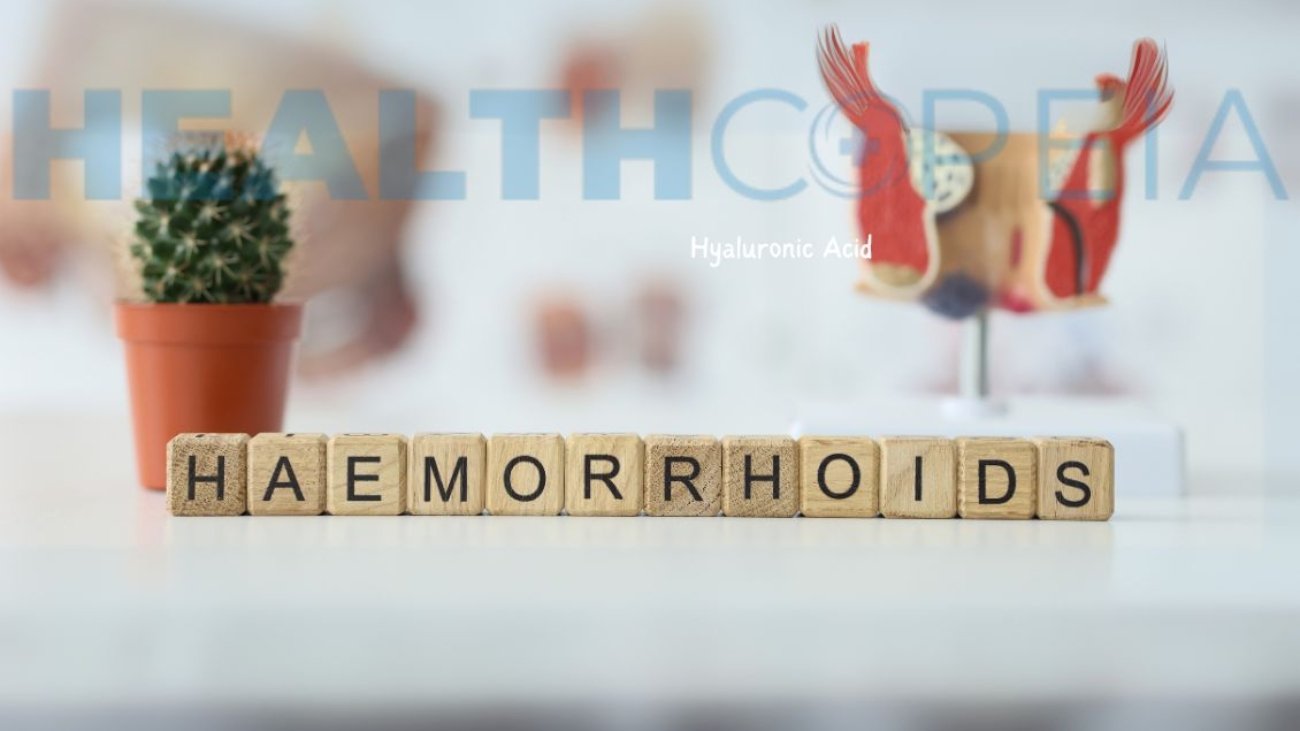 The Ultimate Guide to Hemorrhoids